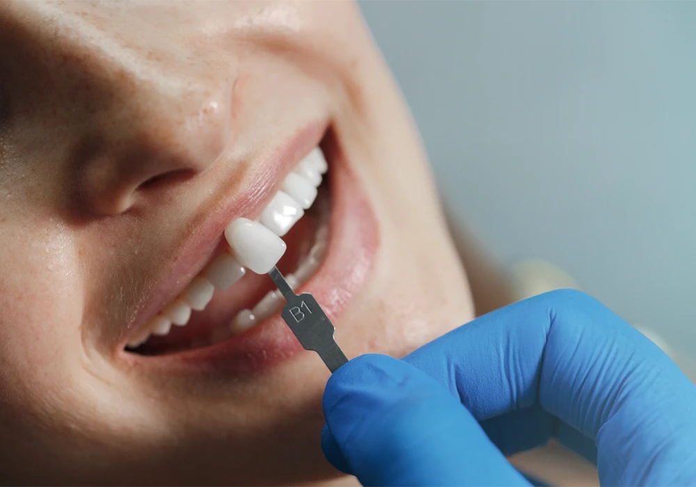 emax veneers implants Istanbul