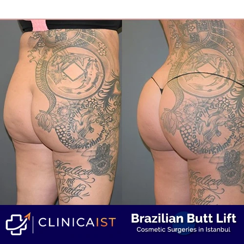 bbl-before-and-after